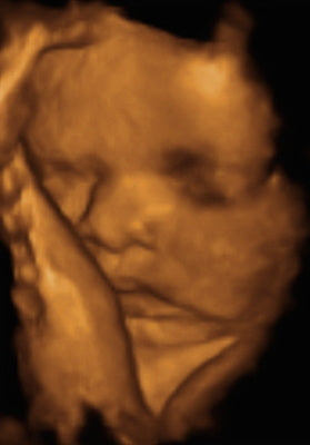 Pregnancy Week image