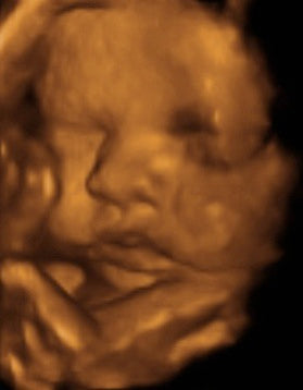 Pregnancy Week image