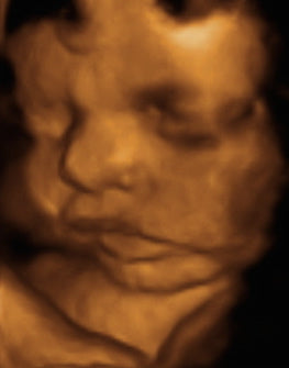 Pregnancy Week image