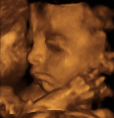 Pregnancy Week image