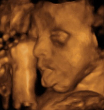 Pregnancy Week image