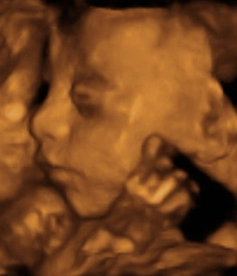 Pregnancy Week image