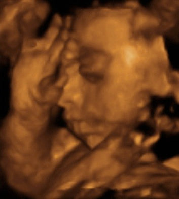 Pregnancy Week image