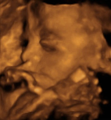 Pregnancy Week image
