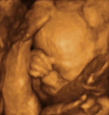 Pregnancy Week image