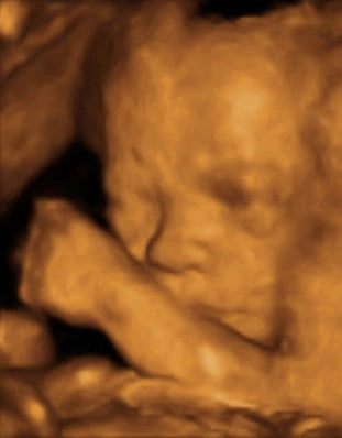 Pregnancy Week image