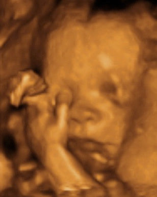Pregnancy Week image