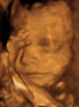 Pregnancy Week image