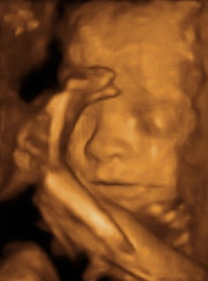 Pregnancy Week image
