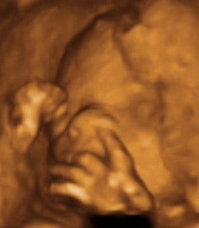 Pregnancy Week image