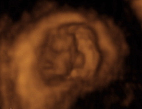 Pregnancy Week image