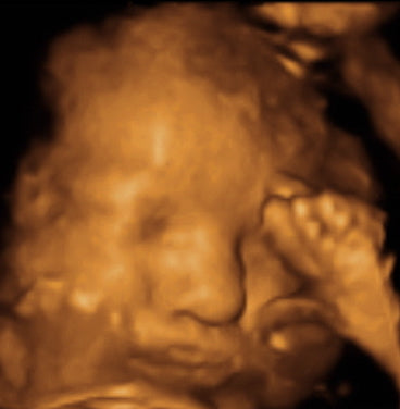 Pregnancy Week image