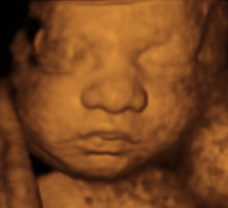 Pregnancy Week image