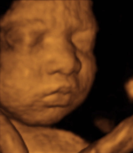 Pregnancy Week image