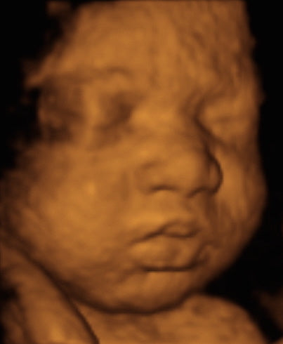 Pregnancy Week image