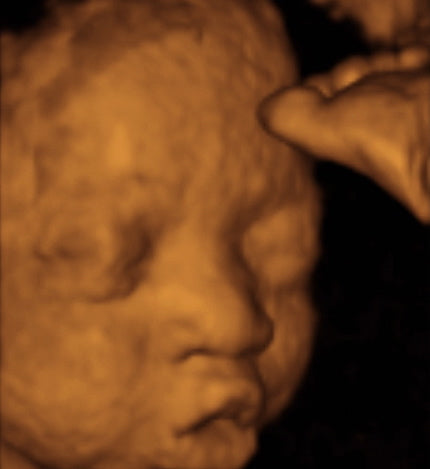 Pregnancy Week image
