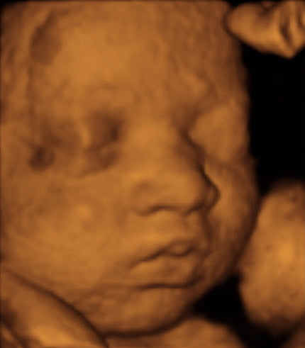 Pregnancy Week image