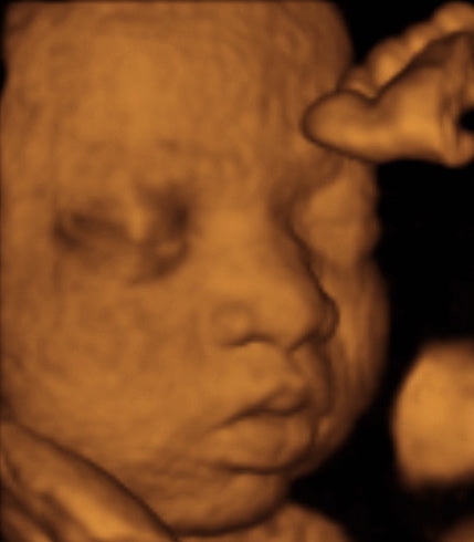 Pregnancy Week image