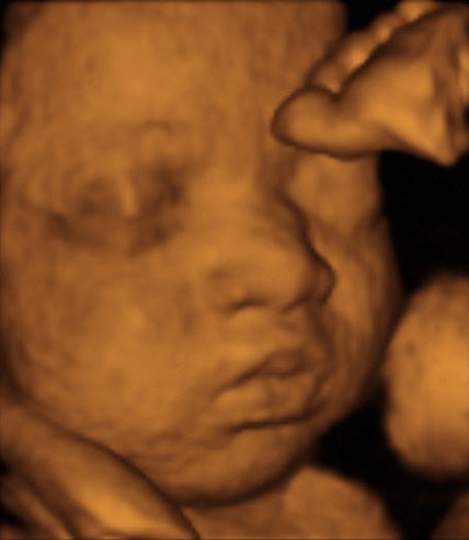 Pregnancy Week image