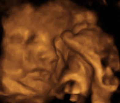 Pregnancy Week image