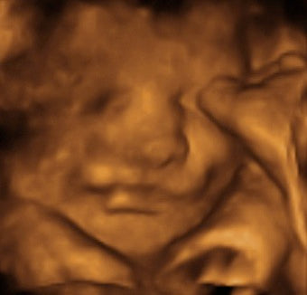 Pregnancy Week image
