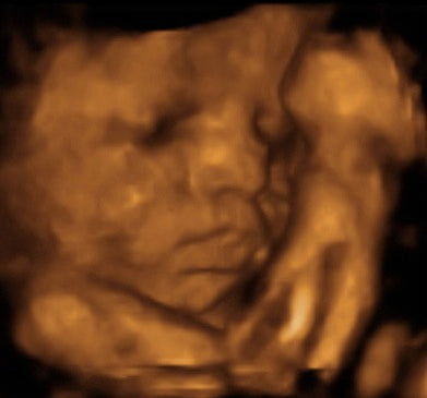 Pregnancy Week image