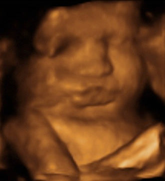 Pregnancy Week image
