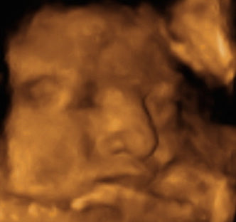 Pregnancy Week image