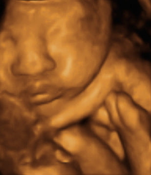 Pregnancy Week image