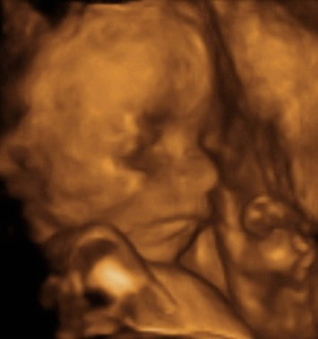 Pregnancy Week image