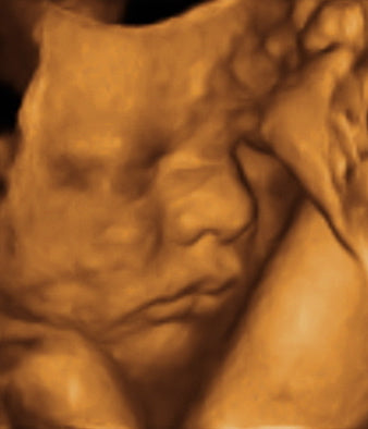 Pregnancy Week image