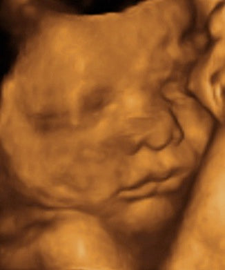 Pregnancy Week image