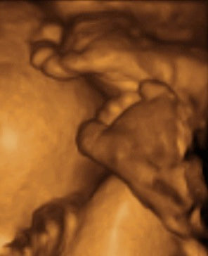 Pregnancy Week image