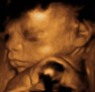 Pregnancy Week image