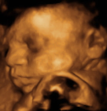 Pregnancy Week image