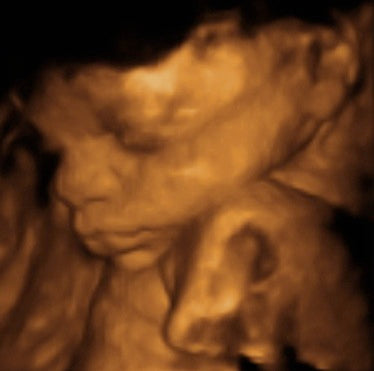 Pregnancy Week image