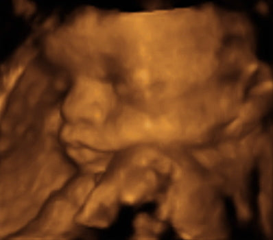 Pregnancy Week image