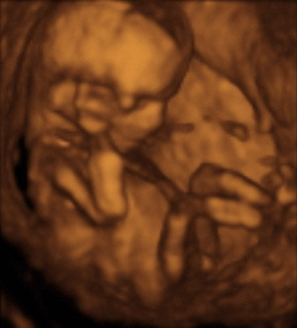 Pregnancy Week image