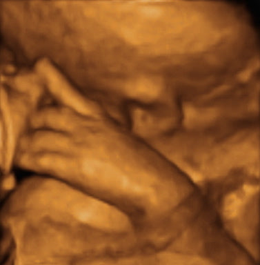 Pregnancy Week image