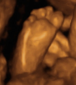 Pregnancy Week image