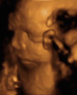 Pregnancy Week image