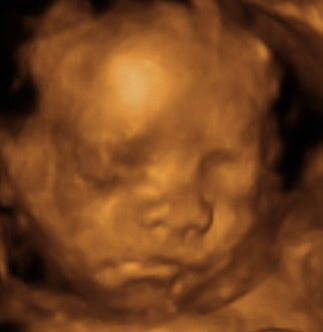 Pregnancy Week image
