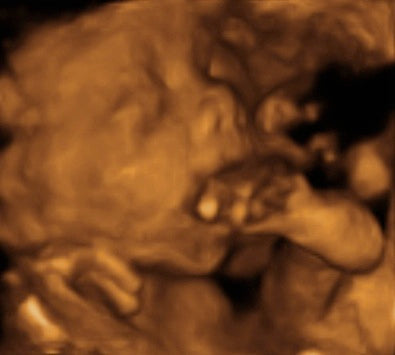 Pregnancy Week image