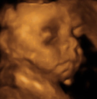 Pregnancy Week image
