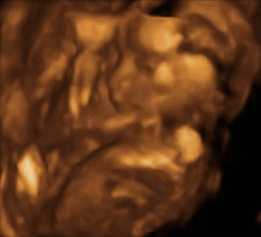 Pregnancy Week image