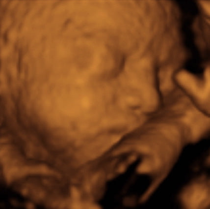 Pregnancy Week image