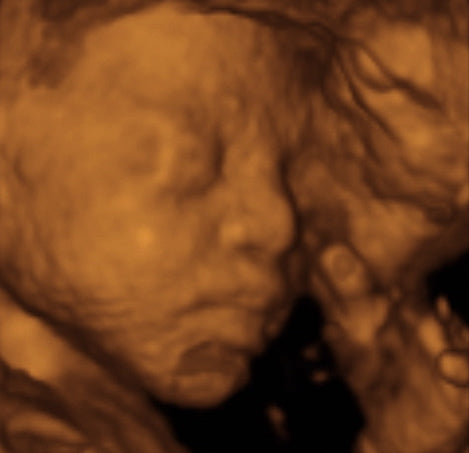 Pregnancy Week image