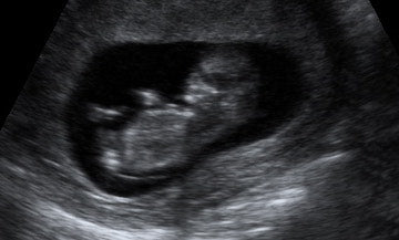 Pregnancy Week image