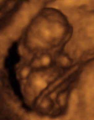 Pregnancy Week image