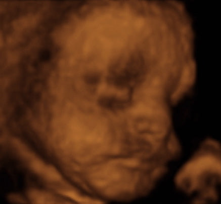 Pregnancy Week image